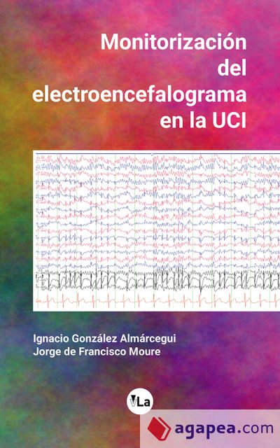 Monitorización del electroencefalograma en la UCI