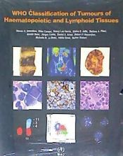 WHO CLASSIFICATION OF TUMOURS OF HAEMATOPOIETIC AND LYMPHOID TISSUES ...