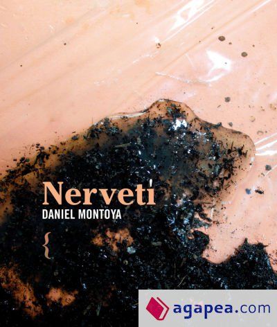 Nervet&iacute;